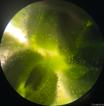 трихомы (14.09).png