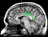 MRI_posterior_cingulate1.png