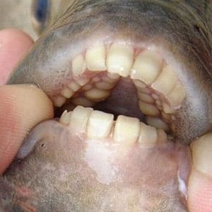 ПАКУ / PACU