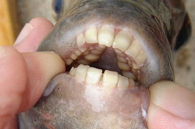 ПАКУ / PACU