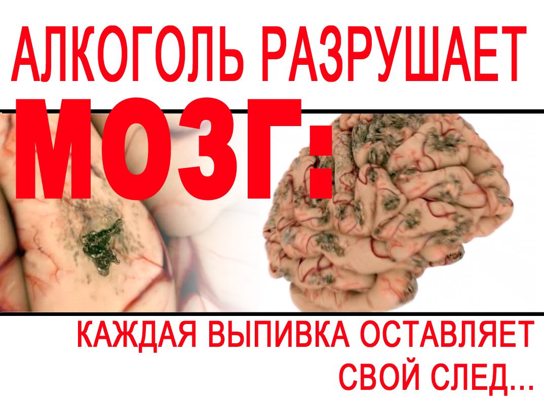 Вред спиртного на организм
